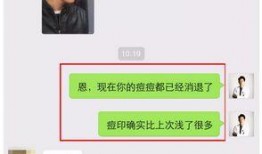 国产福利视频抄底视频,揭秘抄底策略，财富增长新篇章